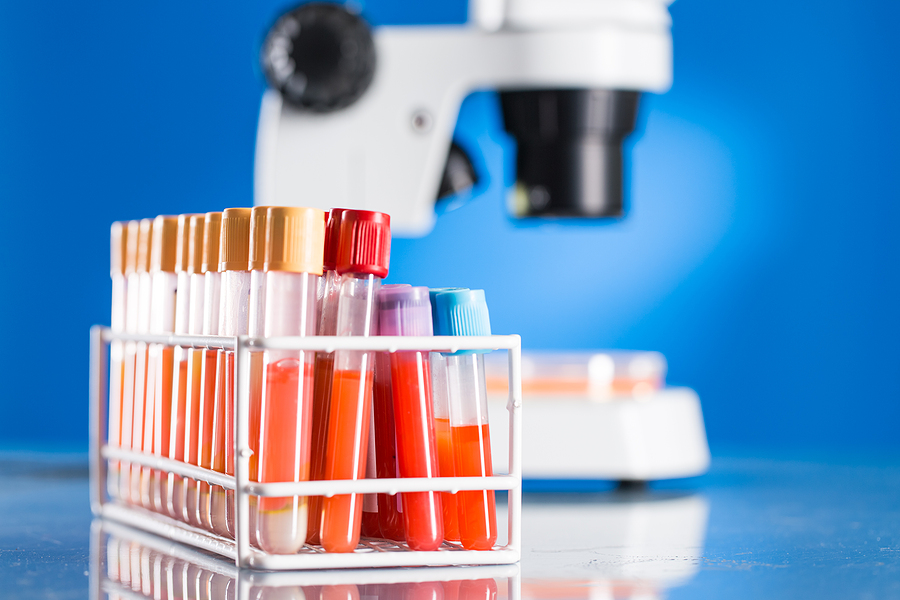 diabetes tests