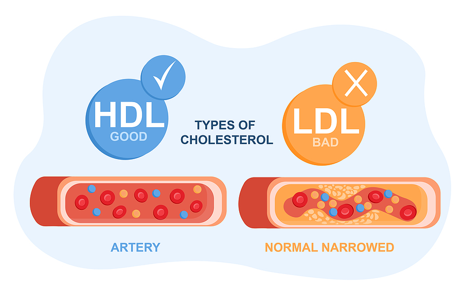 LDL and HDL cholesterol